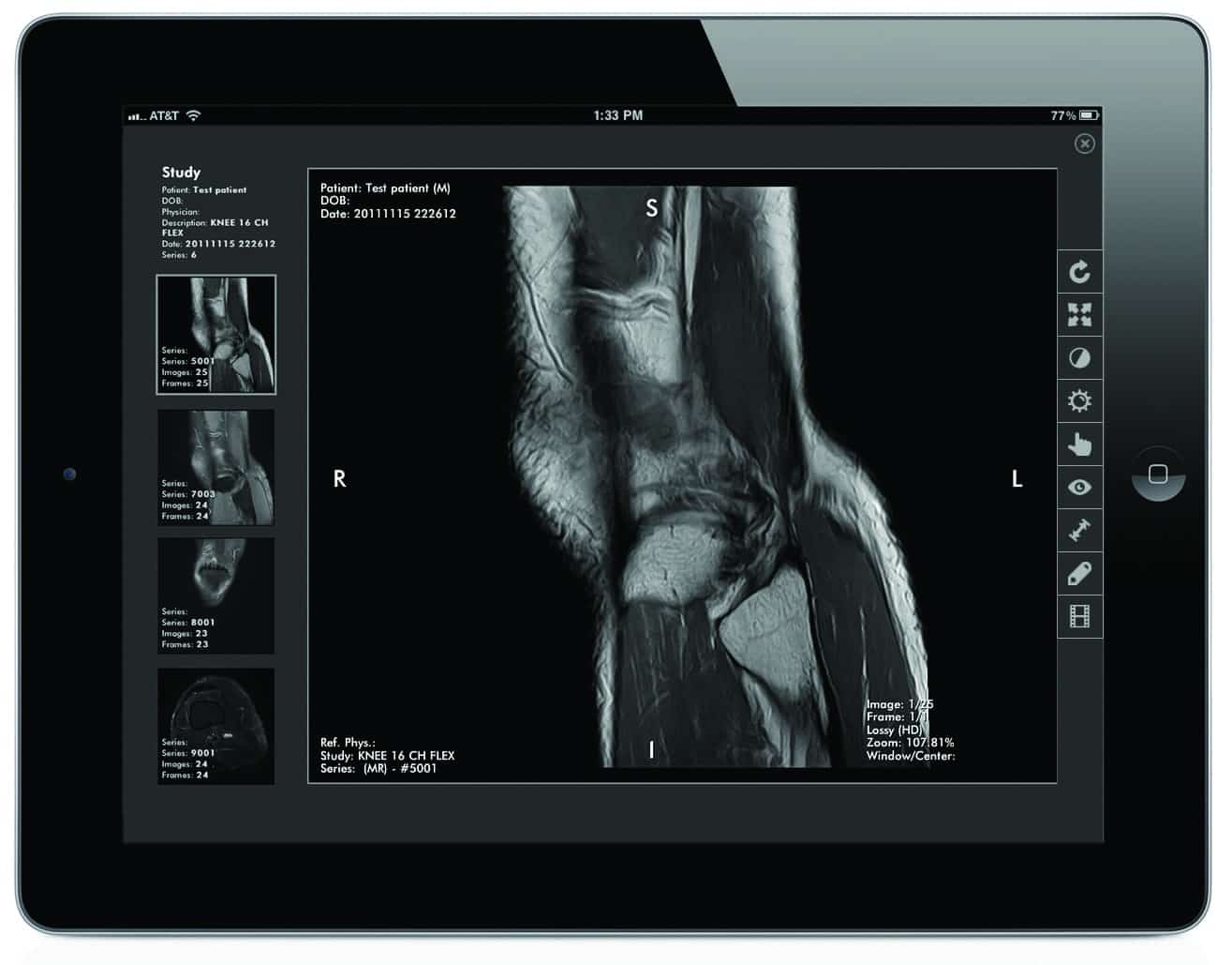 DICOM Grid_Mobile_Viewer