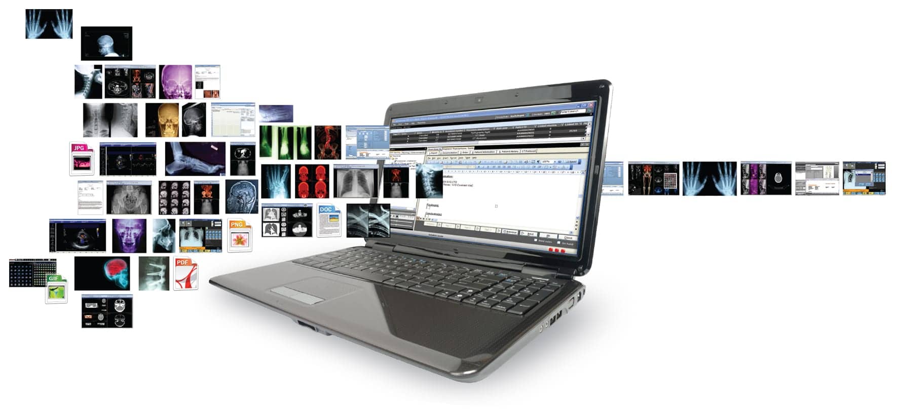 CARESTREAM Vue