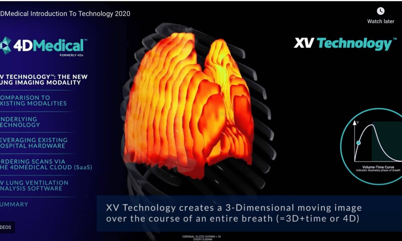 4DMedical’s Lung Imaging Technology Receives FDA Clearance