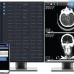 Viz.ai Launches AI-Powered Viz Radiology Suite