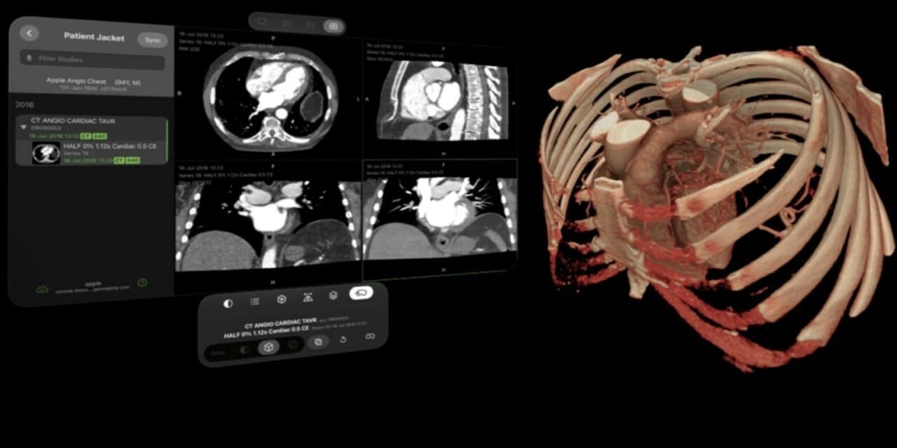Visage Launches Visage Ease VP for Apple Vision Pro