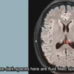 New RadiologyInfo.org Series Helps Patients Understand Their Exam Reports