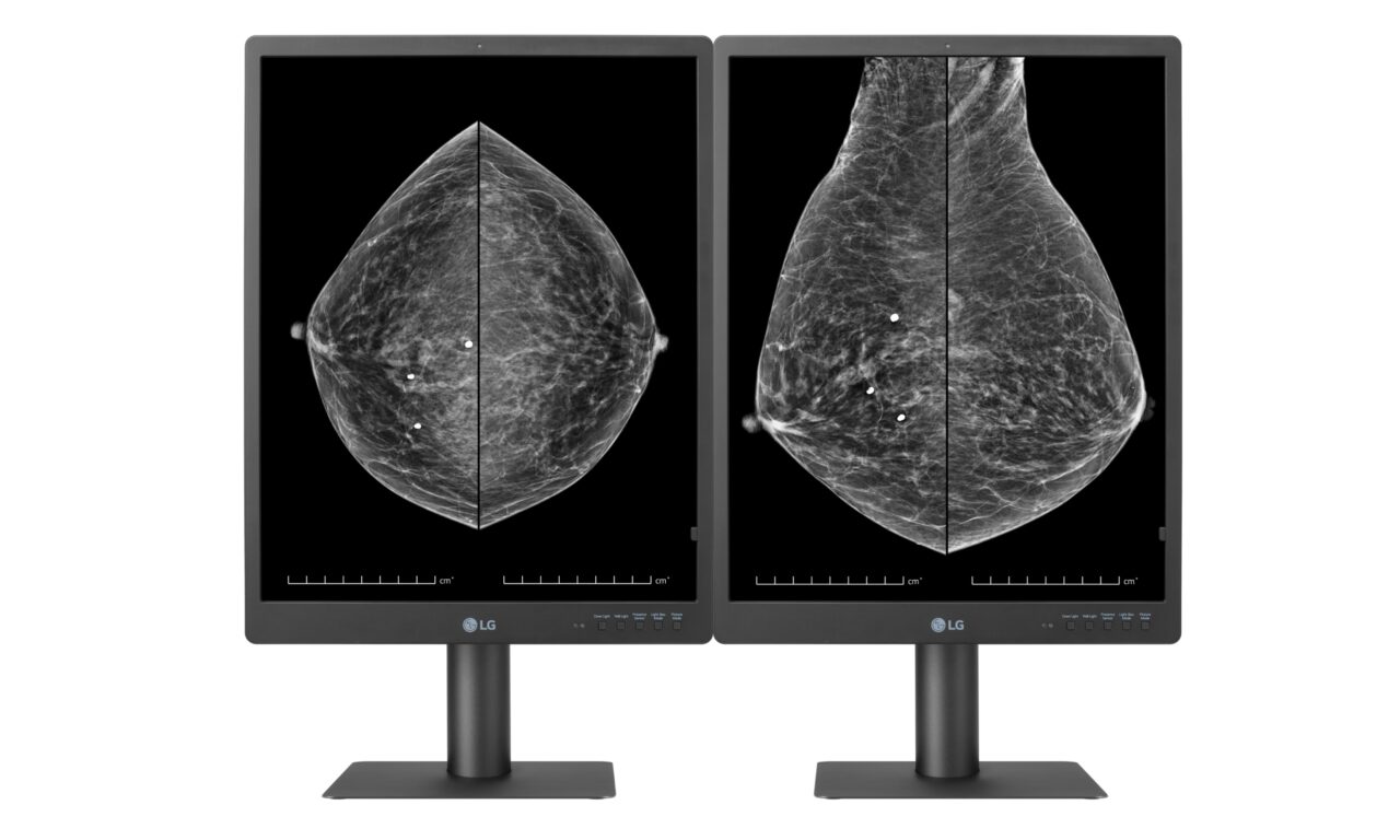 LG Unveils 5MP Diagnostics Monitor for Breast Imaging