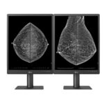 LG Unveils 5MP Diagnostics Monitor for Breast Imaging