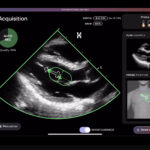 HeartFocus, Butterfly Network Partner for Cardiac Ultrasound Training