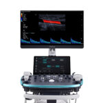 Mindray Introduces Resona I8 Ultrasound Machine