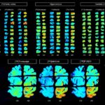 PET Radiotracers Outperform FDA-Approved Detector