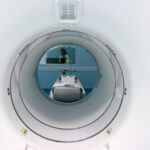 New Standards Aim to Optimize Fibroblast Activation Protein PET Imaging Quality