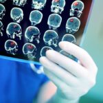 PET Imaging Confirms Dopamine’s Role in Cognitive Flexibility