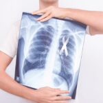 ACR to Launch Early Lung Cancer Detection Registry