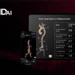 RapidAI Receives FDA Clearance for Aortic Management CT Analysis Tool