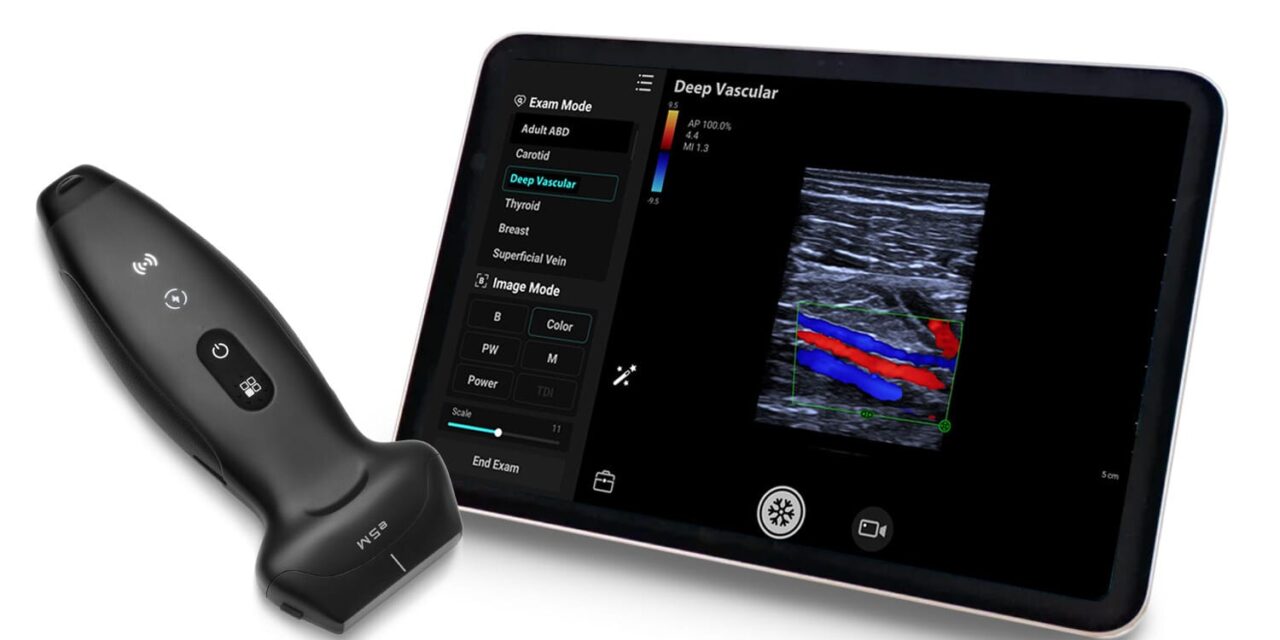 New Mindray TE Air e5M Expands Wireless Handheld Ultrasound Line