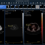 Sirona Earns FDA Clearance for Cloud-Based PET-CT Visualization and Reporting