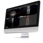 Konica Minolta and deepc Bring AI Tools Directly into Exa Radiology Workflows