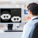 RevealDx’s AI Lung Nodule Tool Receives EU MDR Certification