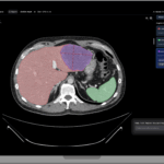 Raidium Unveils New AI-Native PACS Viewer