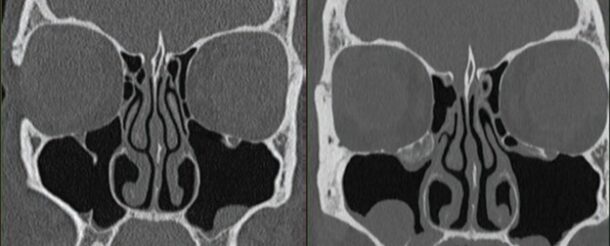 The review traces how hardware, scanning techniques, and reconstruction advances—including photon-counting CT—have enabled large dose reductions while maintaining diagnostic performance. 