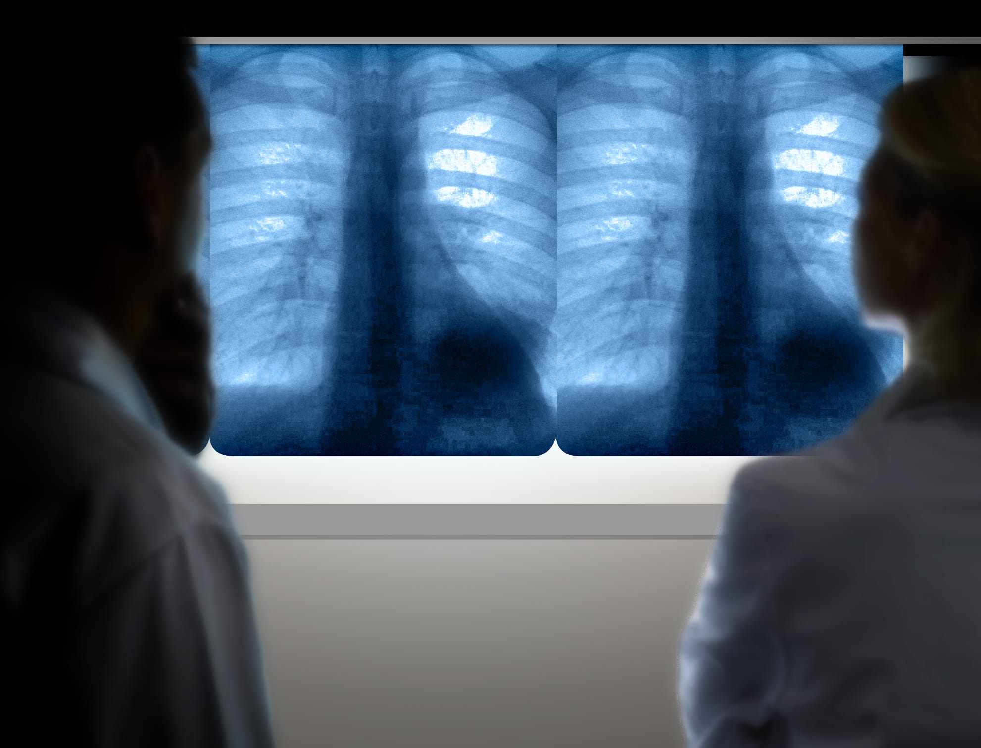 FDA Clears AI System for Chest X-ray Analysis with Six New Indications ...