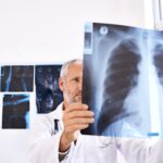 FDA Clears AI Device for Lung Cancer Detection and Diagnosis