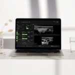 PIUR Imaging Updates AI Thyroid Ultrasound Software to Reduce Workflow Time
