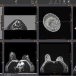 QT Imaging Debuts Unified Viewer for Multimodality Breast Imaging