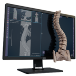 Avatar Medical Secures FDA Clearance for 3D Medical Imaging Platform