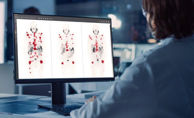 GE HealthCare Highlights Nuclear Medicine Imaging, AI Tools at SNMMI ...